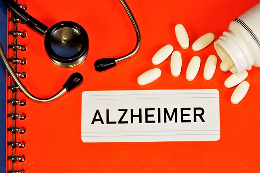What are the Methods for Diagnosing Alzheimer’s in Barrie, ON