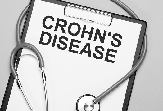 Tips Seniors Can Manage Crohn's Disease in Barrie, ON